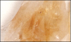 Citrine