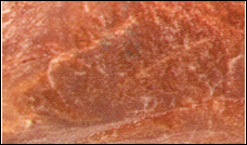 Moonstone